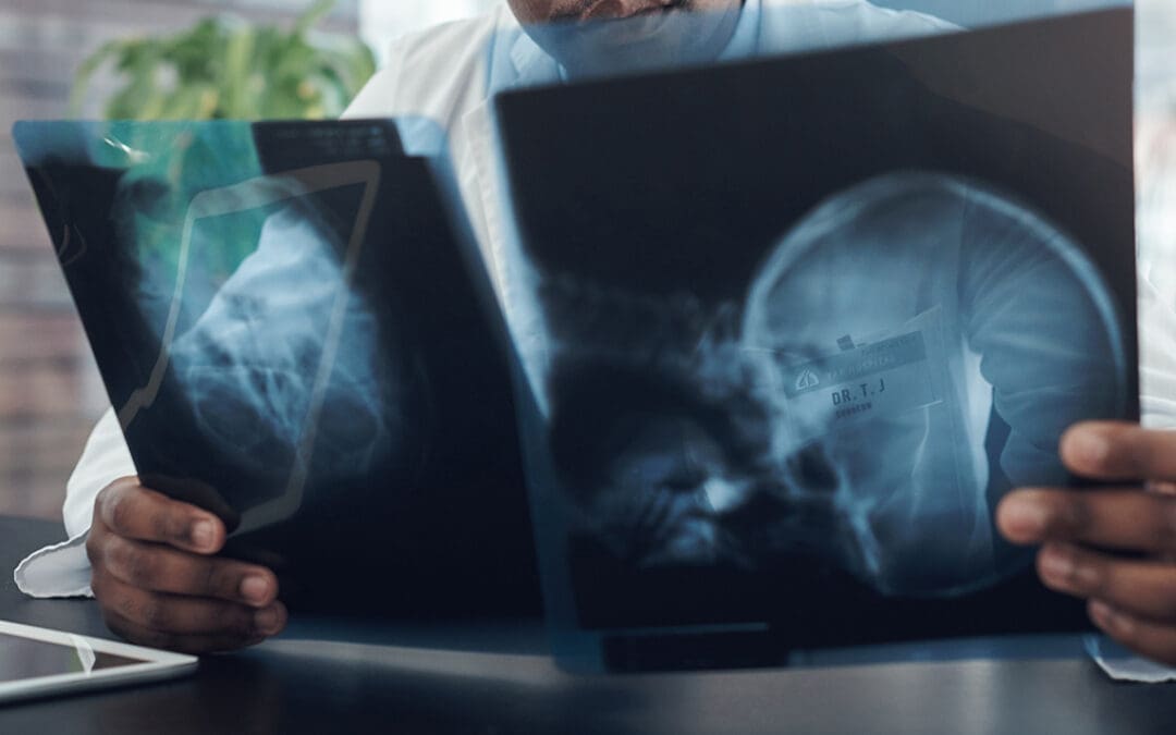 Building A Future Where Brain Injury Is Recognized—Not Missed