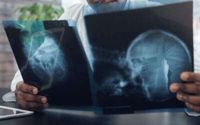 Building A Future Where Brain Injury Is Recognized—Not Missed